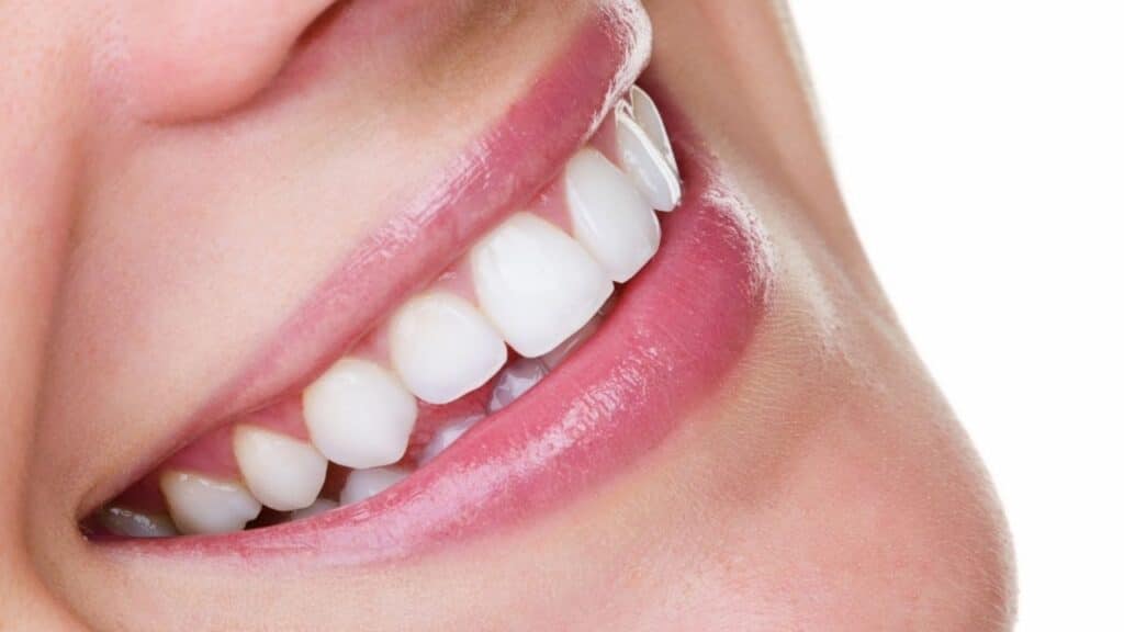 stain removal in brighton